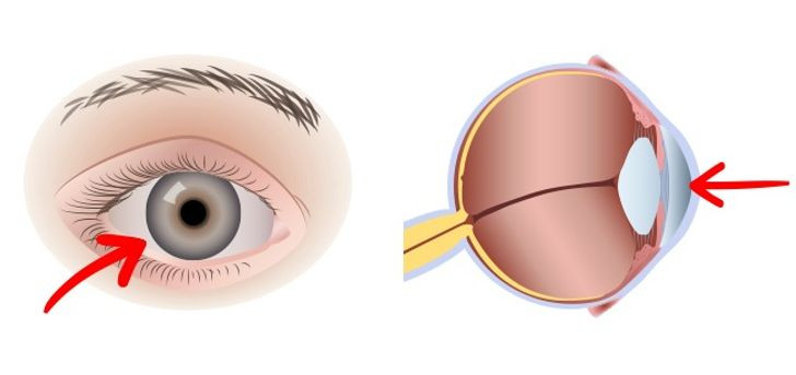 Giúp duy trì thị lực