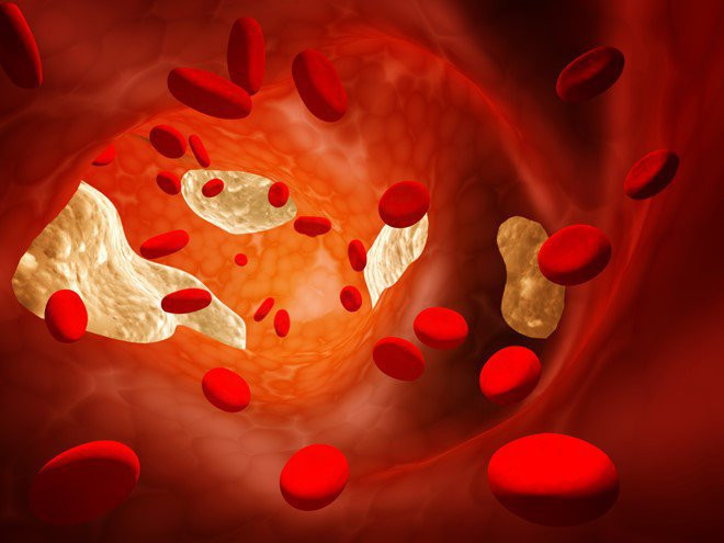 Hình ảnh hiển vi điện tử của cholesterol trong cơ thể người