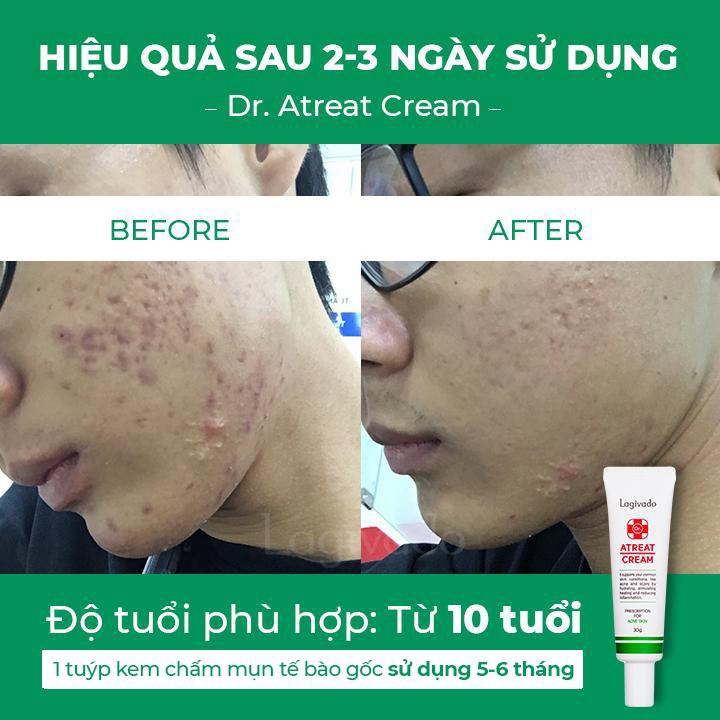 Kem trị mụn Hàn Quốc Lagivado Dr. Atreat Crea