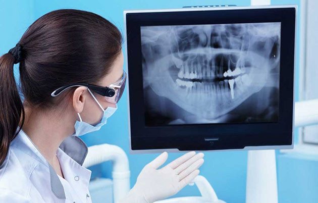 Chụp X-quang răng