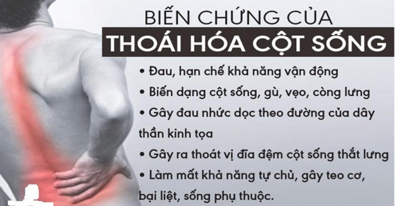 Biến chứng thoái hóa cột sống