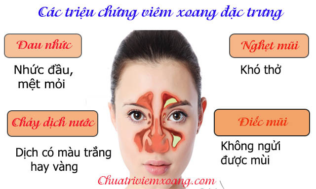 Triệu chứng của viêm xoang