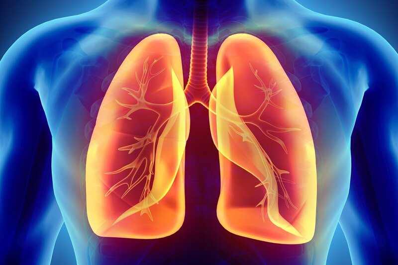 Tràn khí màng phổi - một trong những biến chứng của suy hô hấp