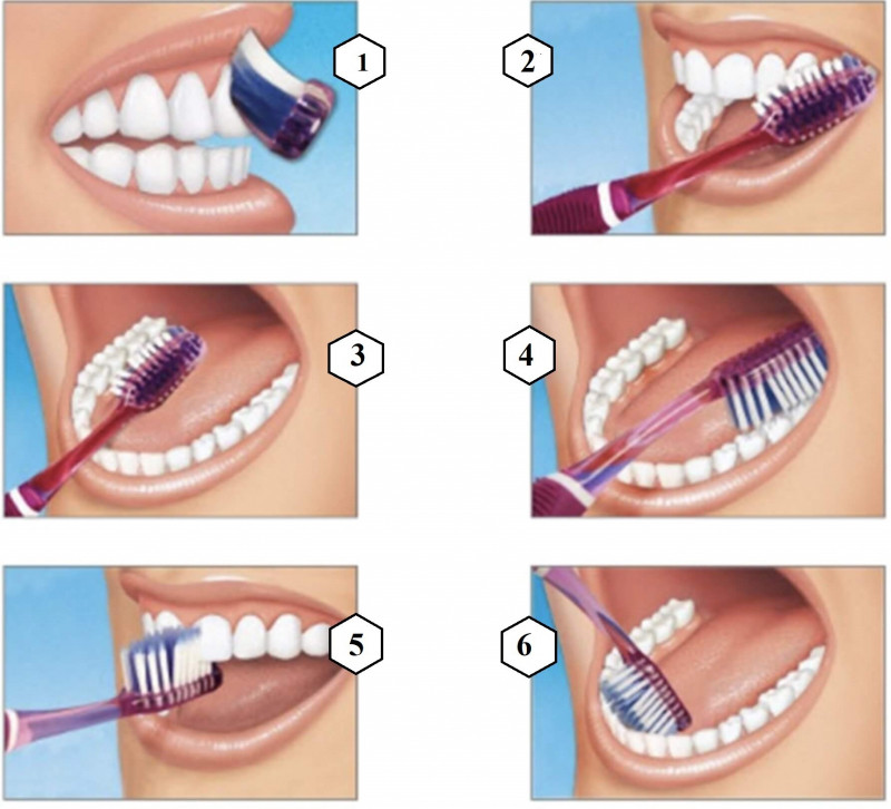 Phương pháp đánh răng Bass cải tiến