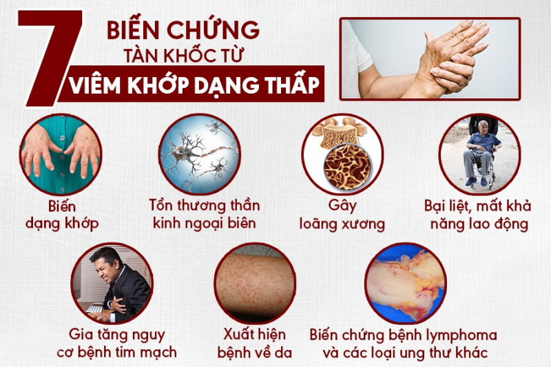 Biến chứng viêm khớp dạng thấp