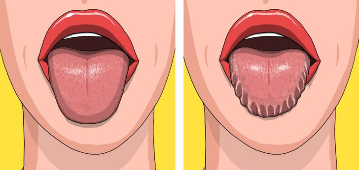 Lưỡi hình vỏ sò