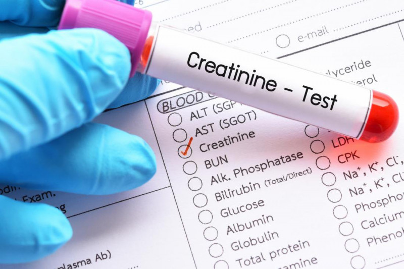 Xét nghiệm creatinine máu có giá trị chẩn đoán cao trong bệnh suy thận